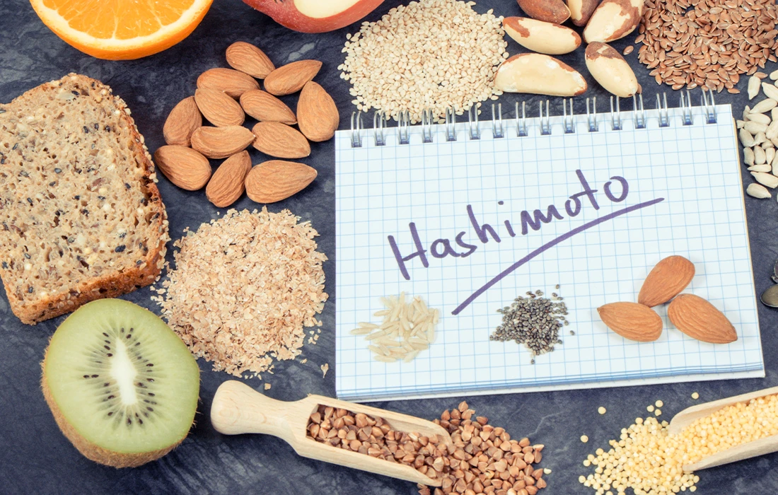 Różne zdrowe produkty spożywcze, w tym orzechy, nasiona, ziarna, kiwi i plastry pomarańczy otaczają notatnik z napisem 